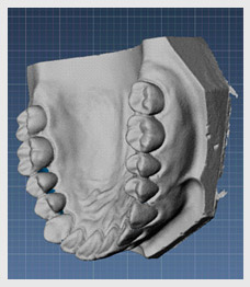 专利3D牙模型